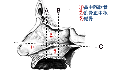 図1：鼻中隔のCTによる弯曲、粘膜肥厚の把握